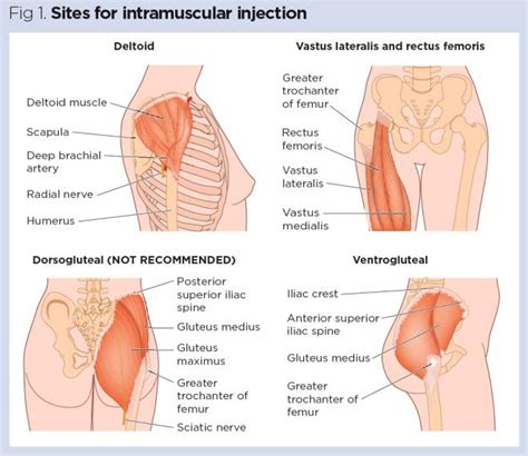 Intramuscular Injection Sites – BuyNeedles.ca