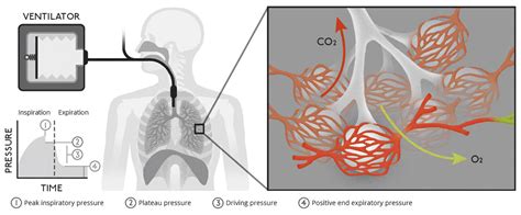 Explaining ventilators for COVID-19