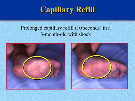 PPT - Pediatric Resuscitation PowerPoint Presentation, free download - ID:6997496