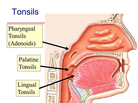 Image result for pharyngeal tonsils | Palatine, Tonsils and adenoids, Lingual tonsils