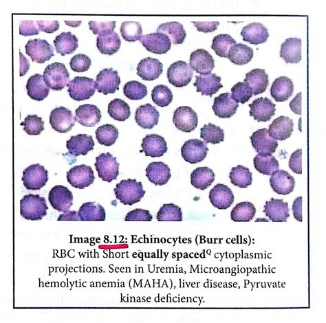 Pin on Haematology