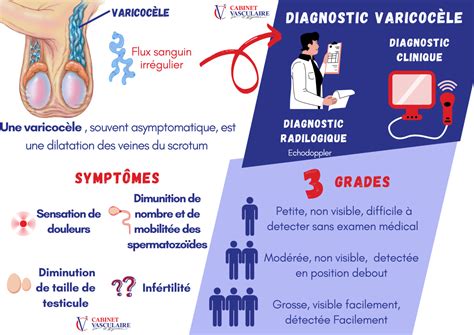 Varicocele of the testicles - Centre Varices Casablanca Maroc