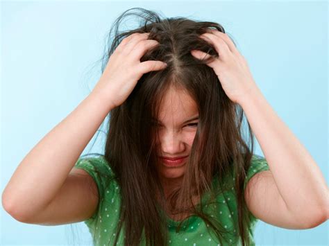 Scalp Scabs Causes And How To Treat Them - vrogue.co