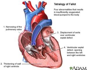 Managing a ‘tet spell’ (In sequence of escalation) - Emergency Medicine Kenya Foundation