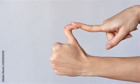 Hand with thumb up, double jointed thumbs, abnormal flexibility. Stock Photo | Adobe Stock