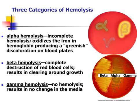 Types Of Hemolytic Disease at Darlene Walker blog