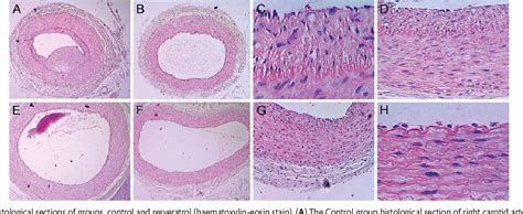 Figure 1 from The effect of resveratrol on intimal hyperplasia and ...