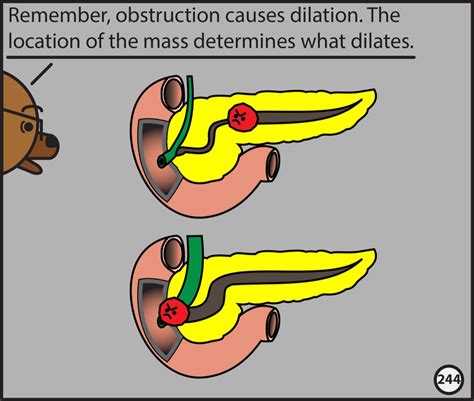 Abdominopelvic CT: The Graphic Novel | Radiopaedia.org