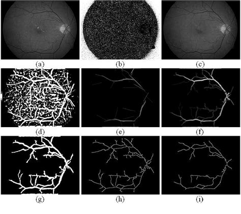 Structure of fundus of eye | Semantic Scholar