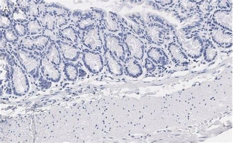 Anti-Caspase-1 (p20) Antibody, clone 2G4 , ZooMAb® Rabbit Monoclonal