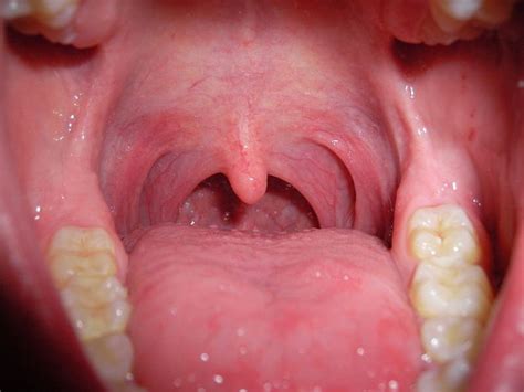 Oral Cavity: Anatomy, Functions, and Diseases | Medical Library