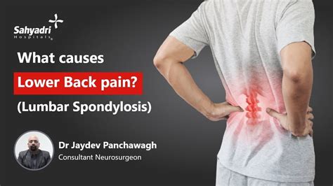 Lumbar Spondylosis Symptoms And Signs