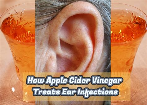 How Apple Cider Vinegar Treats Ear Infections - Apple Cider Vinegar