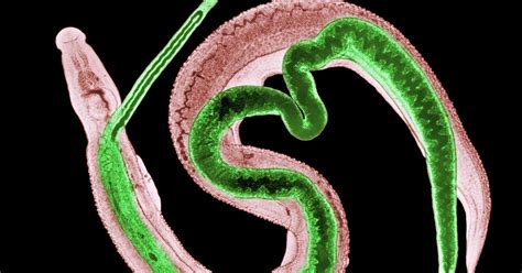 They’re Hosting Parasitic Worms in Their Bodies to Help Treat a ...