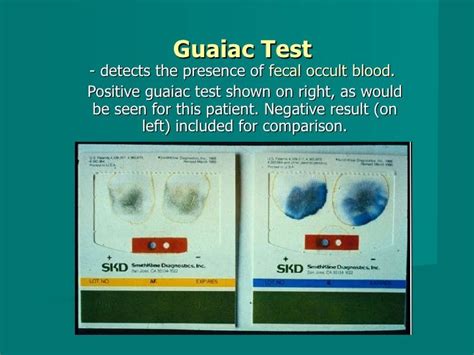 Image result for guaiac test positive | Nursing notes, Nursing school tips, Laboratory science