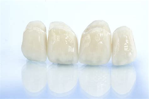 Porcelain Restorations - Channo DDS