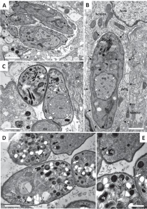 Transmission electron microscopy of Neospora caninum tachyzoites... | Download Scientific Diagram