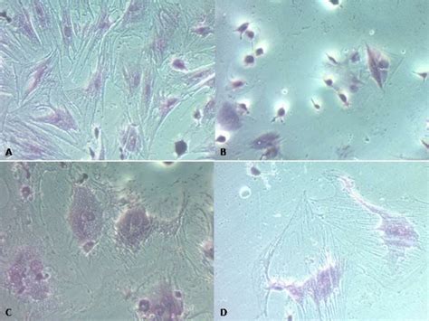 Giemsa stain (x200), A&B : Photomicrographs of colonies formed by human... | Download Scientific ...