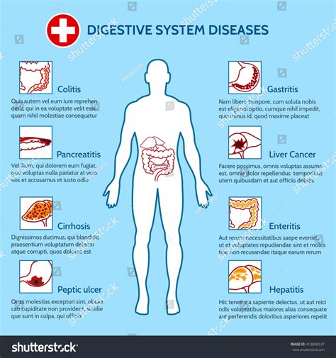 Human Digestive System Diseases Medical Infographics Stock Vector ...