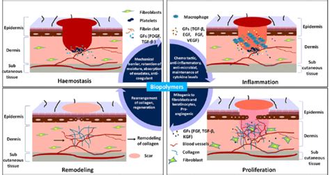 Schematics of wound healing phases [186]. Hemostasis begins right after... | Download Scientific ...