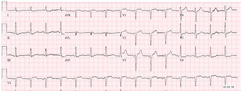 Dr. Smith's ECG Blog