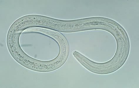 CDC - DPDx - Intestinal Hookworm