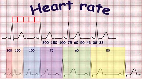 How To Calculate Heart Rate On Ecg | Images and Photos finder