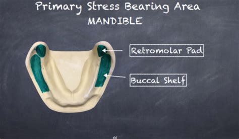 Retromolar Pad Anatomy