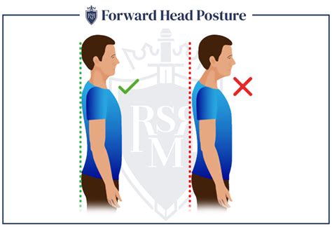 How To Fix Bad Posture (Man's Guide) | Tips To Improve Your Posture