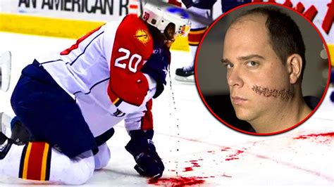 15 SCARIEST Injuries In Hockey - YouTube