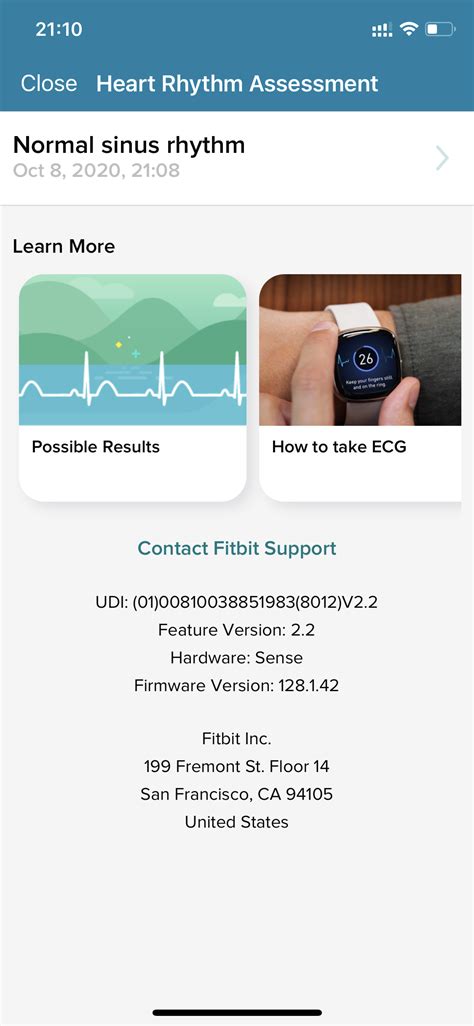 Fitbit Activates the ECG App on the Sense Smartwatch