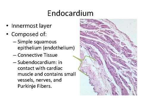 Histology for Pathology Cardiac System Theresa Kristopaitis MD