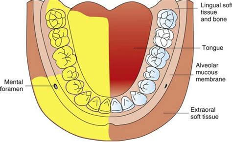 Long Buccal Nerve Block