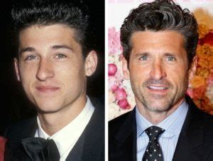 Patrick Dempsey Before and After Plastic Surgery