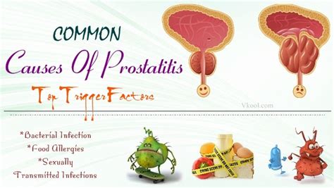 Common Causes Of Prostatitis – Top 11 Trigger Factors