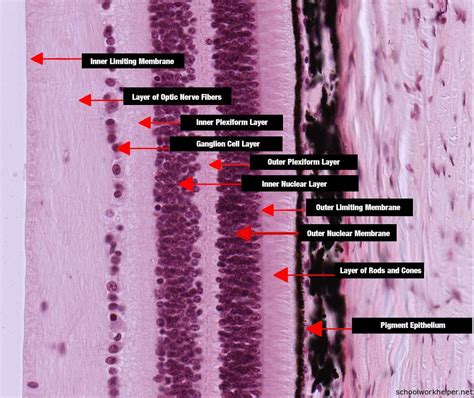 retina-labelled-histology-slide | SchoolWorkHelper