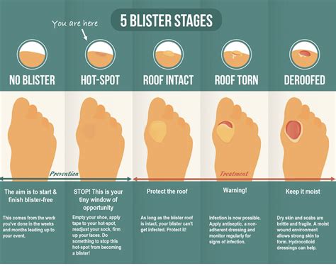 AMR Aid Station: Running Blisters 101 - Another Mother Runner