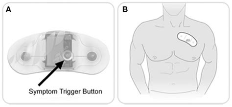 Ziopatch cardiac monitor. Zio Patch button and placement. (A) Patients... | Download Scientific ...