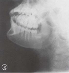 CE4RT - Radiographic Positioning Face and Mandible for X-ray Techs