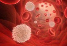 Low lymphocytes-Causes, Symptoms, Diagnosis &Treatment