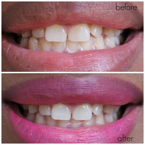 Colgate Optic White Before and After | Naturally Glam | Jonna Scott-Blakes