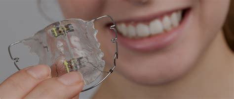 Removable braces – Orthodontic Sense