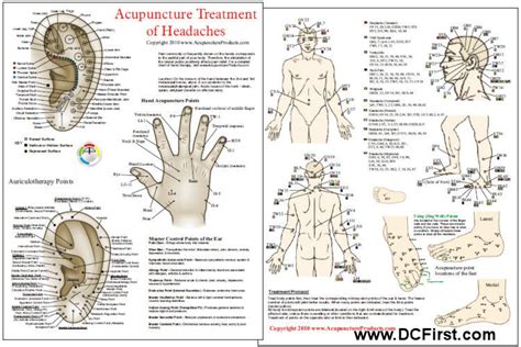 Acupuncture Treatment of Headaches Chart