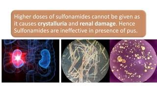 Sulphonamides and sulfa drugs | PPT