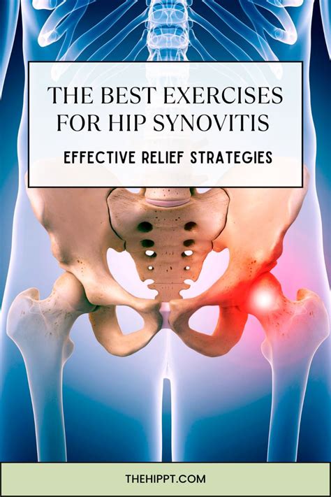 The Best Exercises for Hip Synovitis: Effective Relief Strategies - The ...