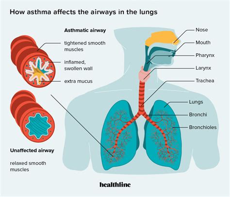 How Does Asthma Affect the Respiratory System?