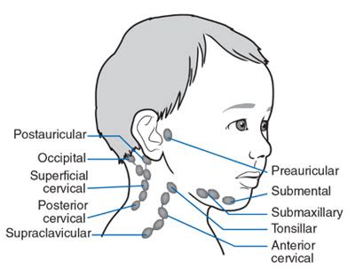 Inflamed lymph node back of neck - tractolf