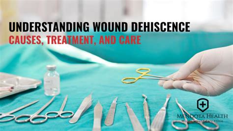 Understanding Wound Dehiscence - Mendota Health