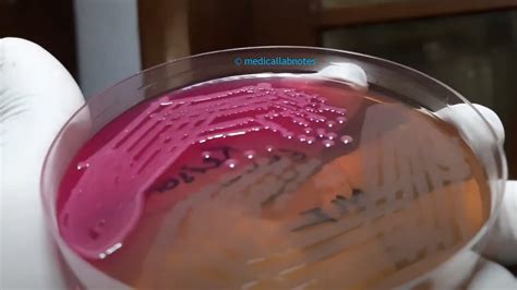 Serratia marcescens colony morphology on MacConkey agar Archives - Medical Notes