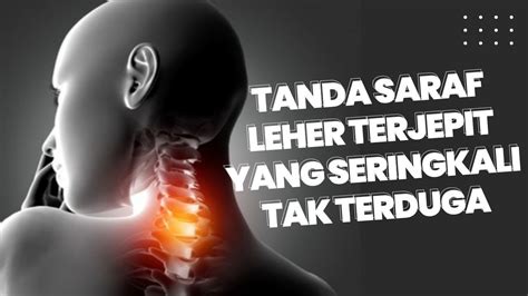 Tanda Saraf Leher Terjepit yang Jarang Disadari - YouTube